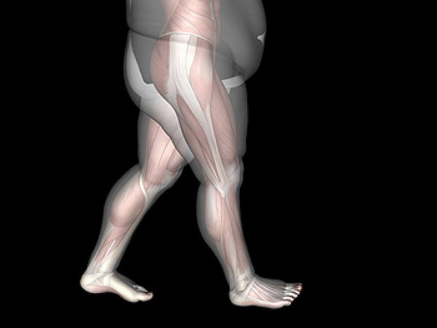 Obesity May Affect the Structure of the 